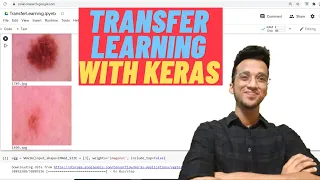 Transfer Learning Using Cnn Vgg 16 Keras Tutorial